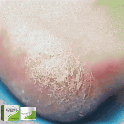 South Moon - 42% Urea Cream (Original)